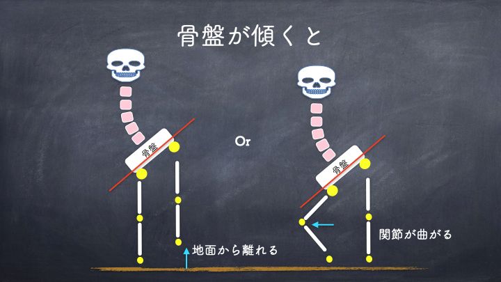 骨盤が傾くと